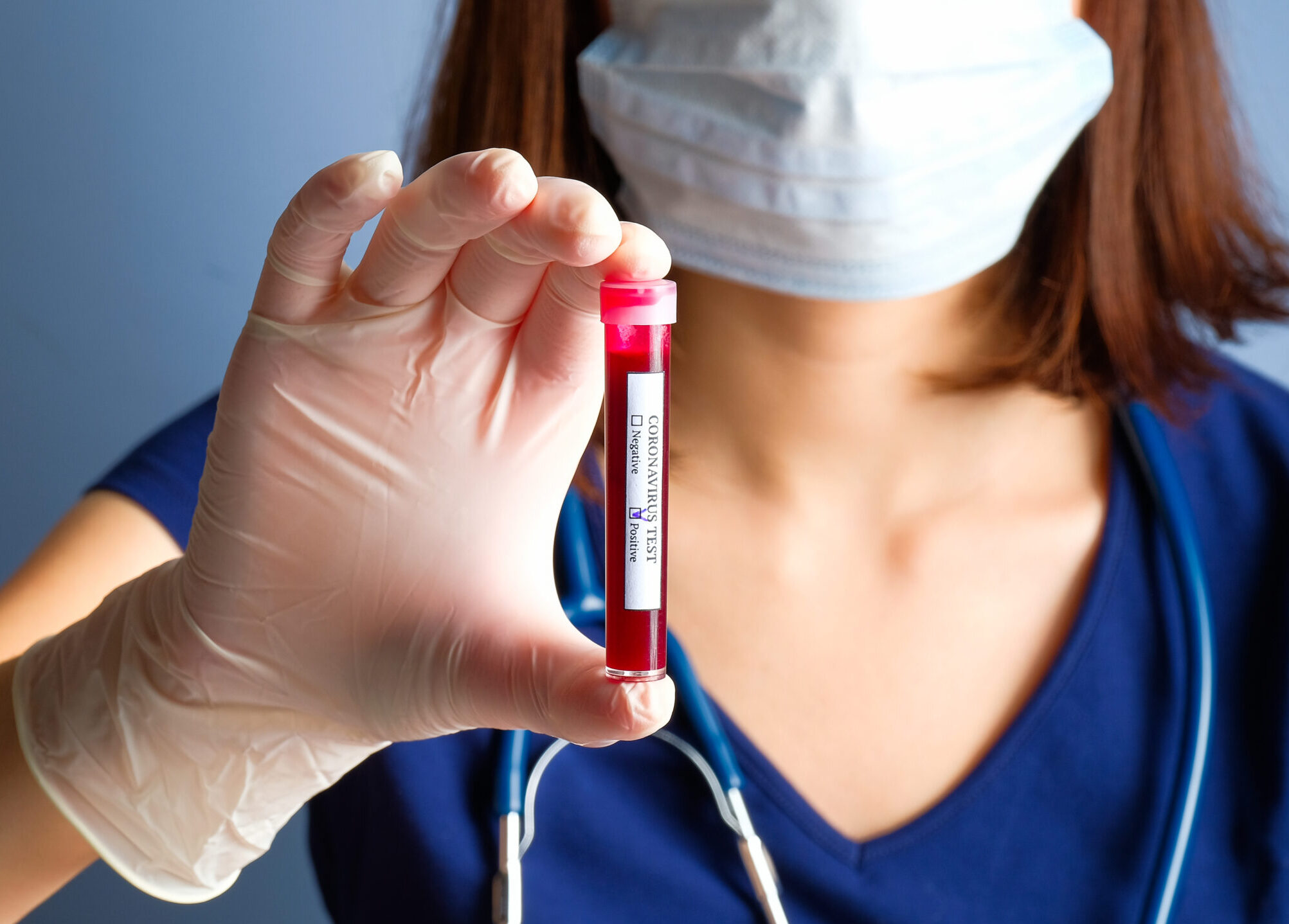 Nurse,Holding,Test,Tube,With,Positive,Coronavirus,Test,Blood,Sample.